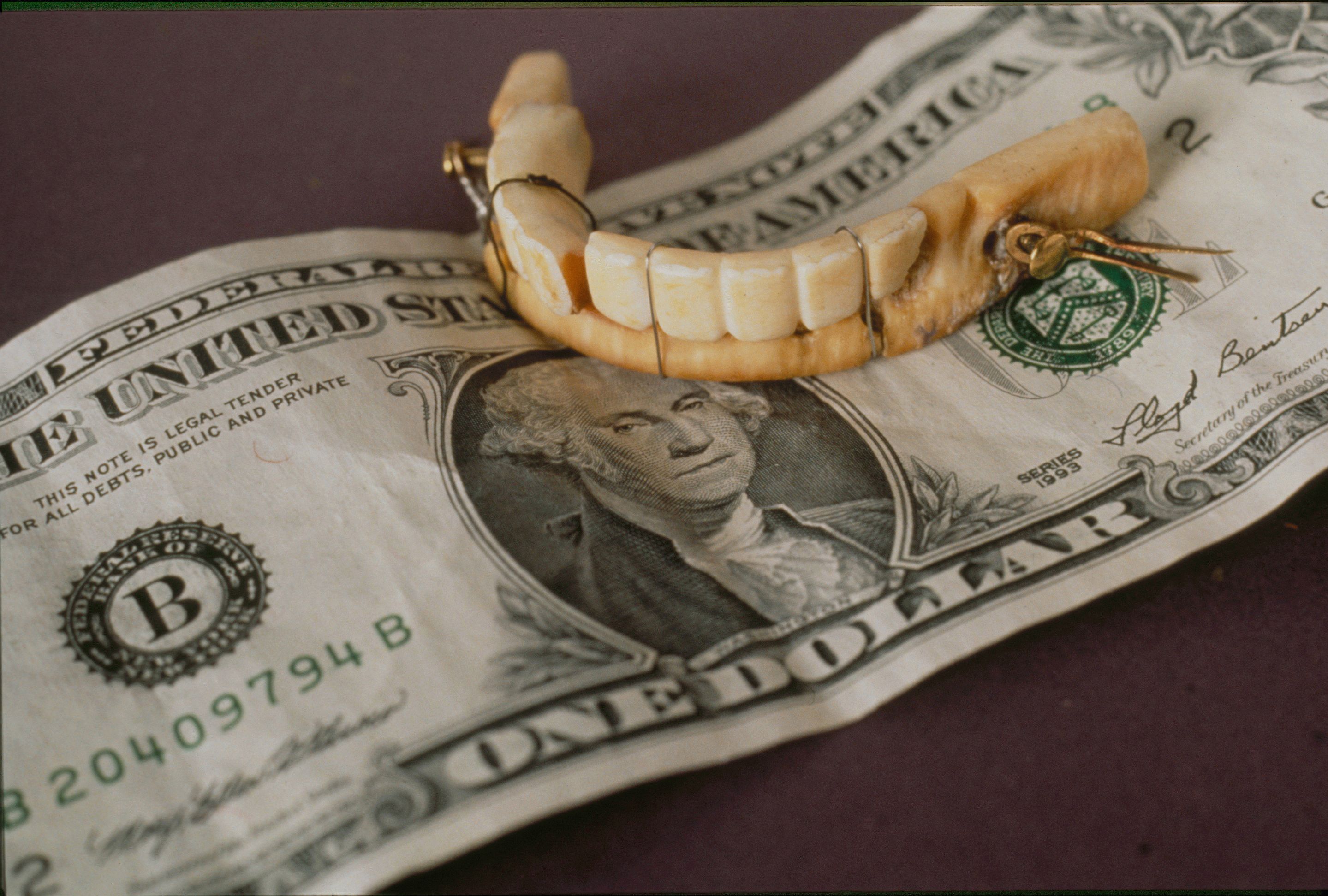 Top 5 Best Denture Locks in 2026