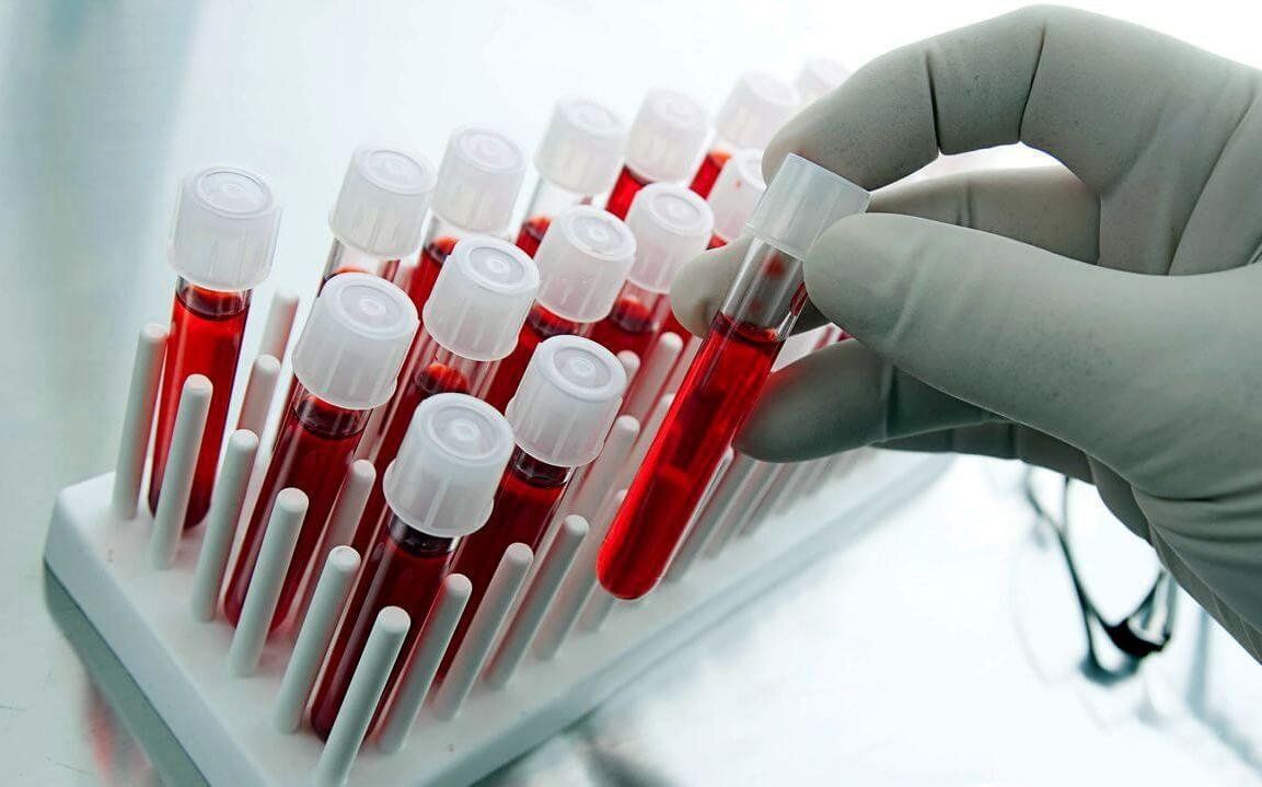 The best medical laboratories for analyzes in Voronezh in 2026