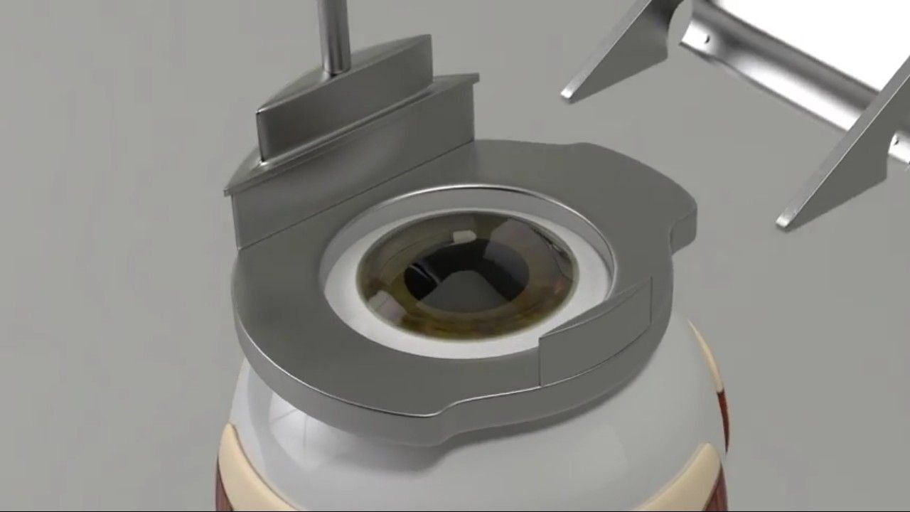 Review of the best ophthalmological clinics in Kazan in 2026