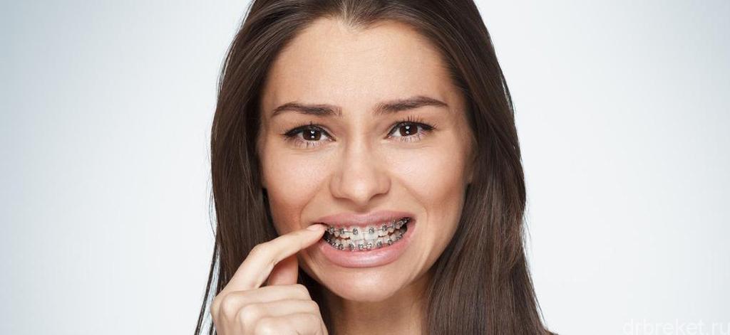 Ranking of the best braces waxes for 2026