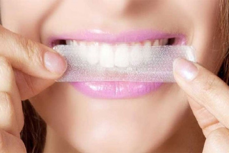 Rating of the best teeth whitening strips for 2026