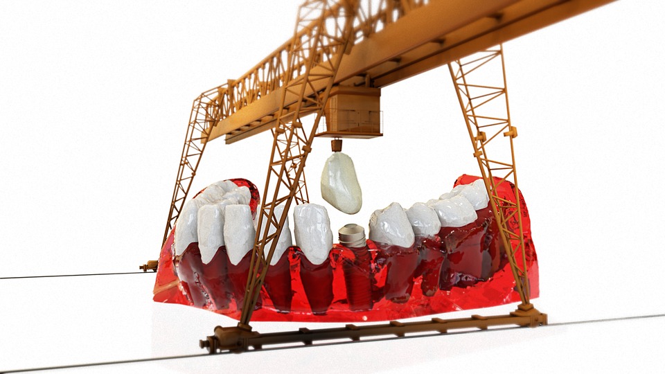 Rating of the best dental implantation clinics in Novosibirsk for 2026