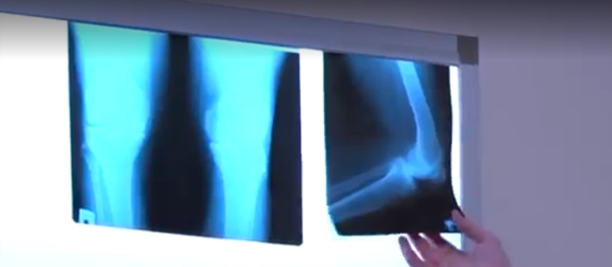 Rating of the best trauma clinics in Moscow for 2026