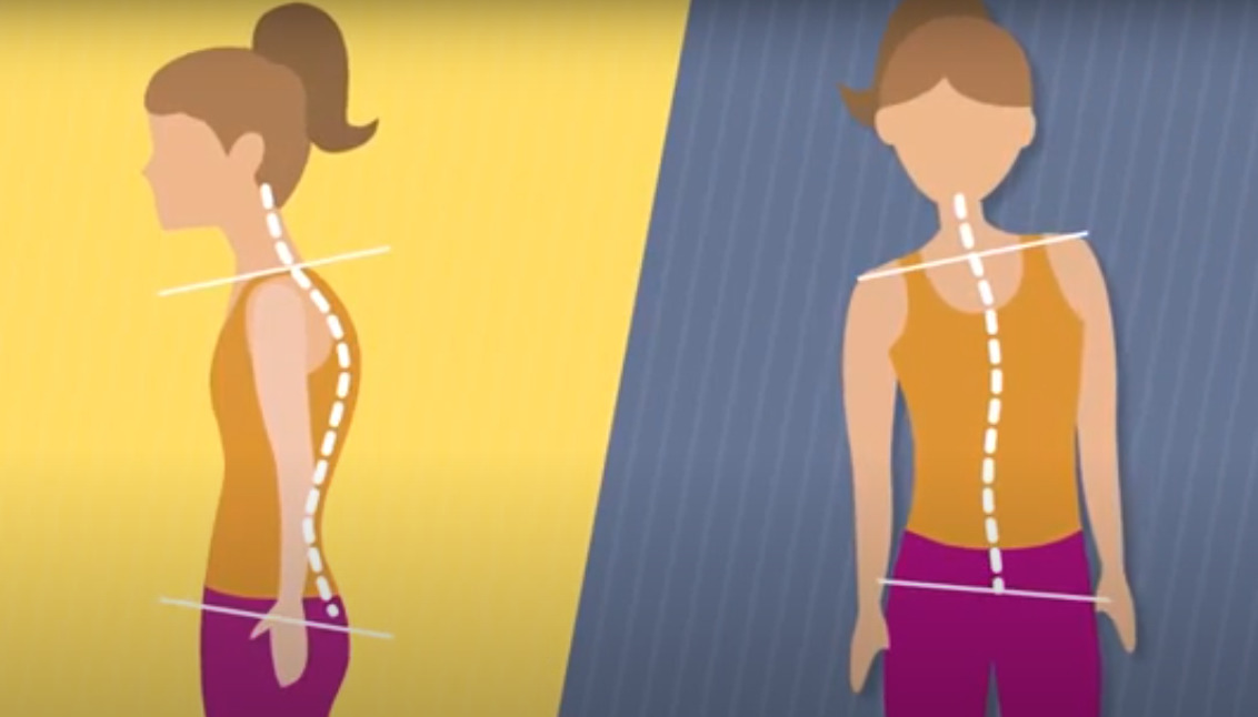 Ranking of the best posture machines for 2026