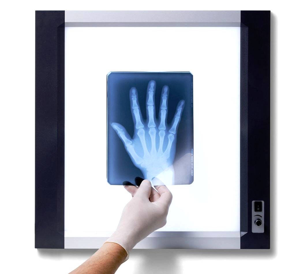 Rating of the best negatoscopes for 2026