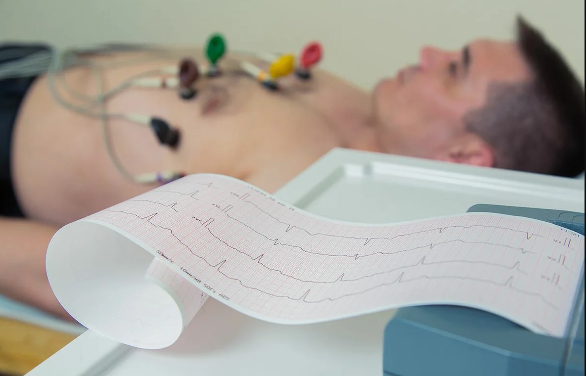 Rating of the best electrocardiographs for 2026