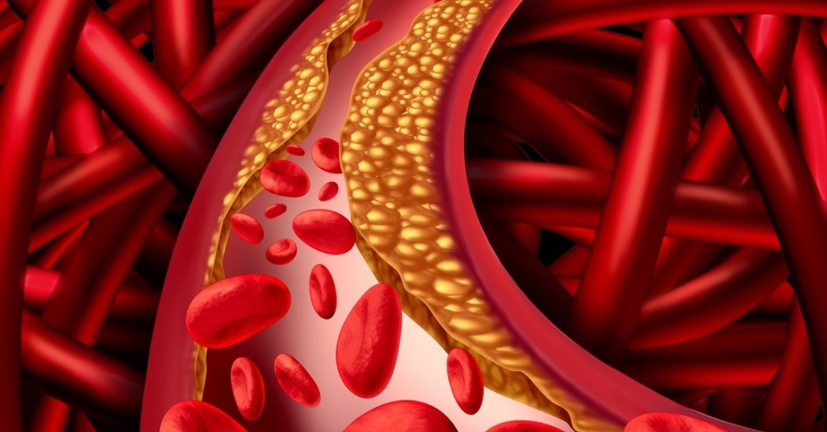 Rating of the best cholesterol pills for 2026