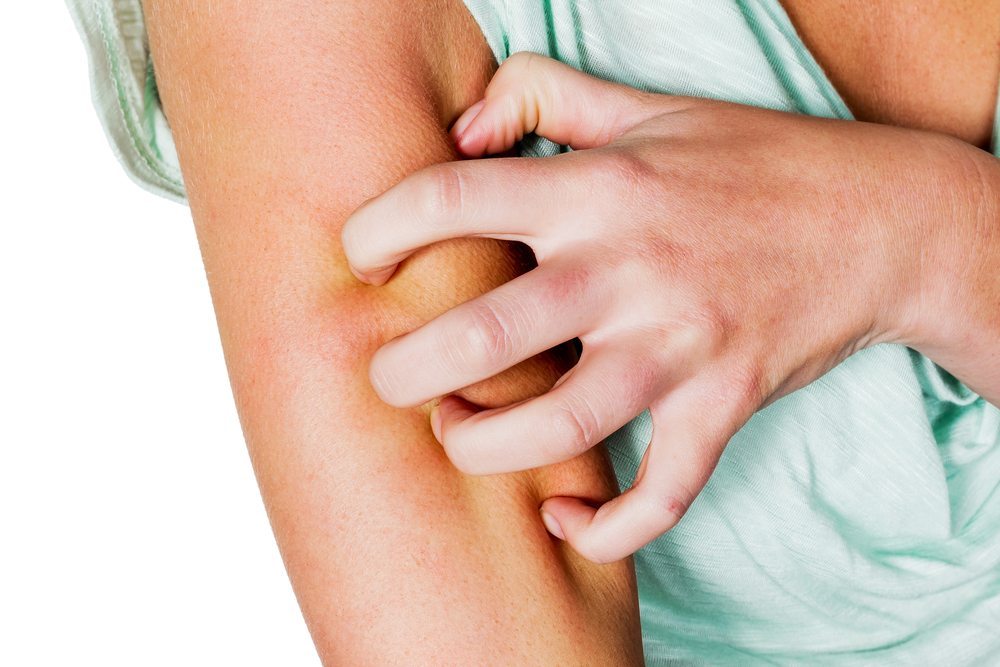 Rating of the best remedies for itchy skin for 2026